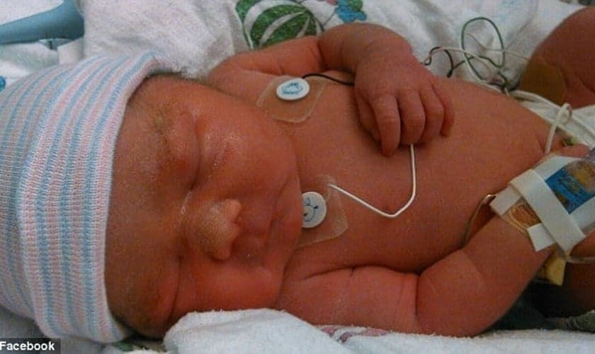 No Alasca, Bebê nasce saudável após morte cerebral da mãe e passa a se chamar "Fé"