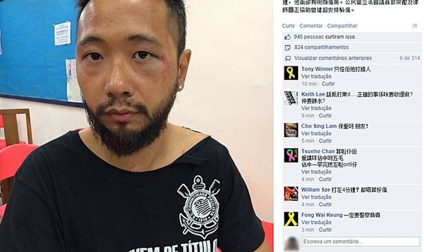 Postagem da página do Partido Cívico no Facebook mostra Tsang ferido após agressão de policiais em Hong Kong