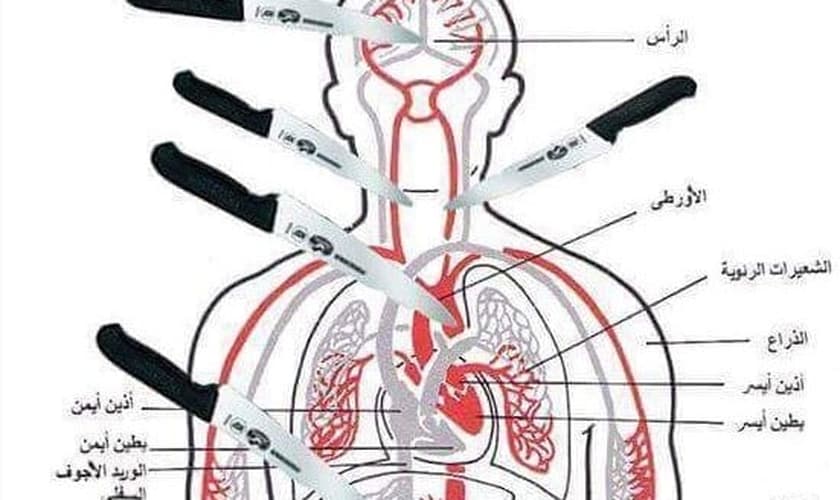 Imagem mostra os pontos principais do corpo a serem atingidos por uma faca, causando rápida fatalidade. (Foto: Times of Israel)