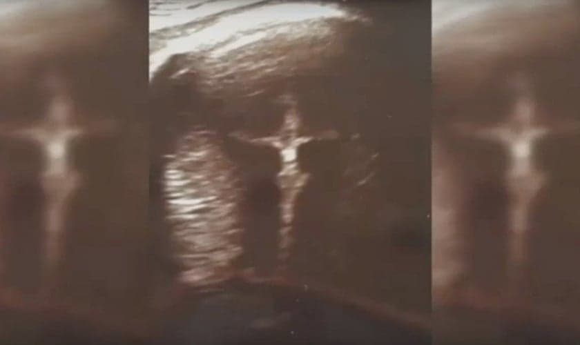 Imagem com recorte do Ultrassom, compartilhada por Aley no Facebook. (Imagem: Youtube / reprodução)