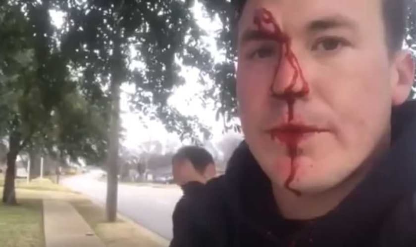 Ryan Roberts ensanguentado após sofrer agressões por causa de seu ativismo pró-vida. (Foto: Reprodução/YouTube).