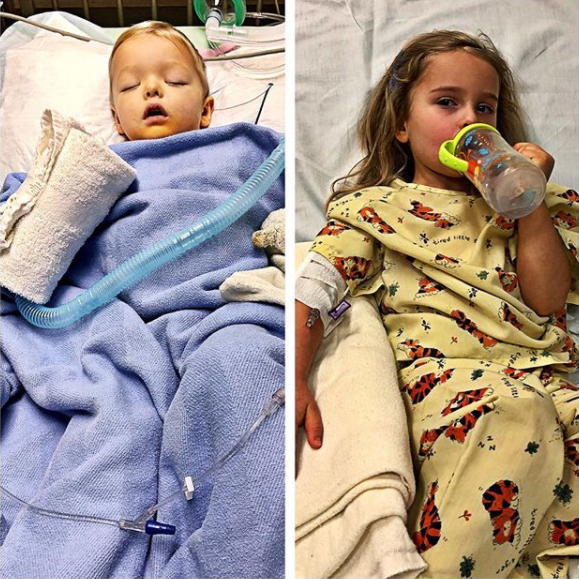 Jaxon, de dois anos e Addie, de quatro anos, contraíram a mesma infecção. (Foto: Reprodução/Instagram)