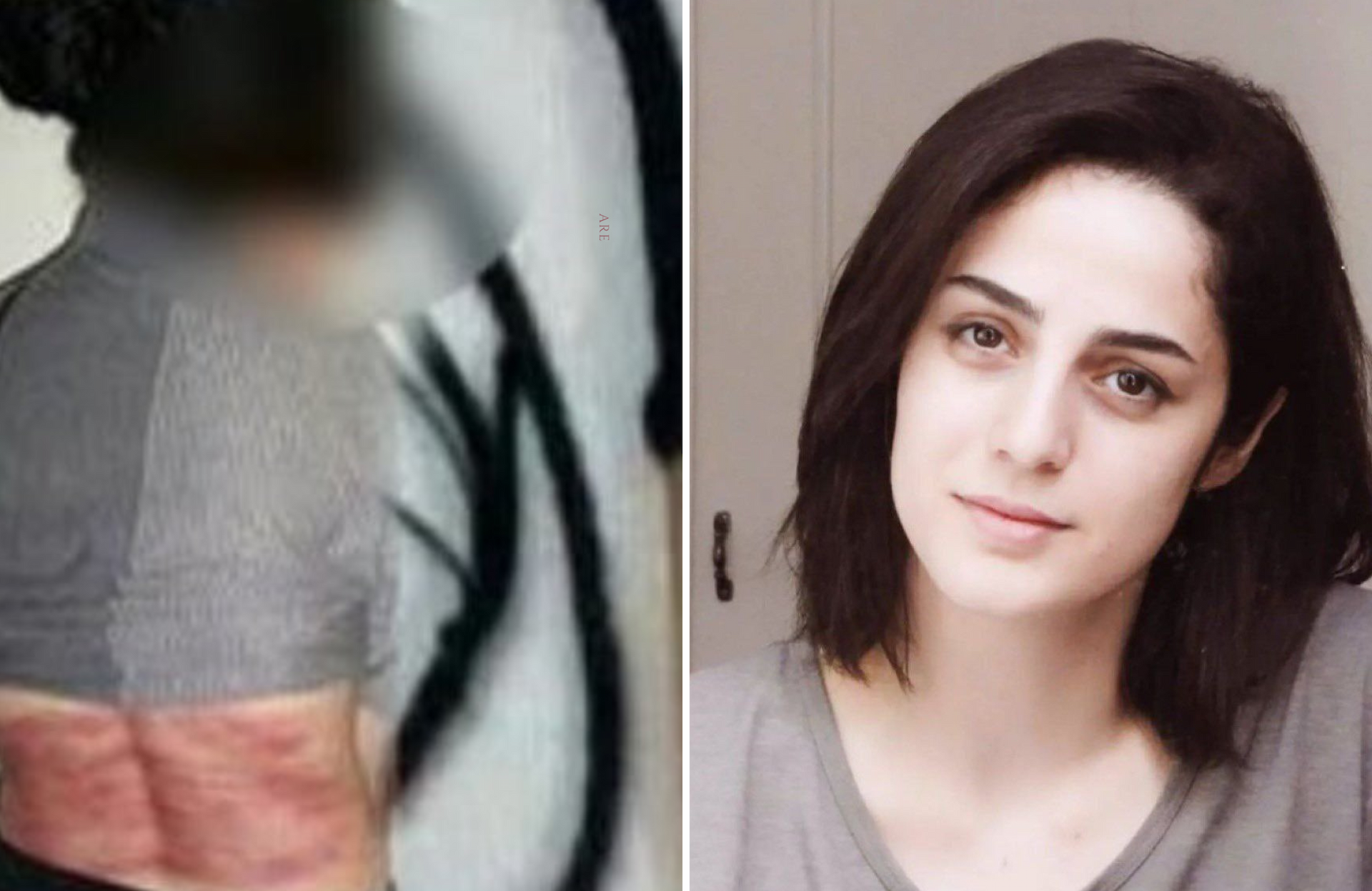 Roya Heshmati foi chicoteada sob lei islâmica. (Foto: X/Avici)