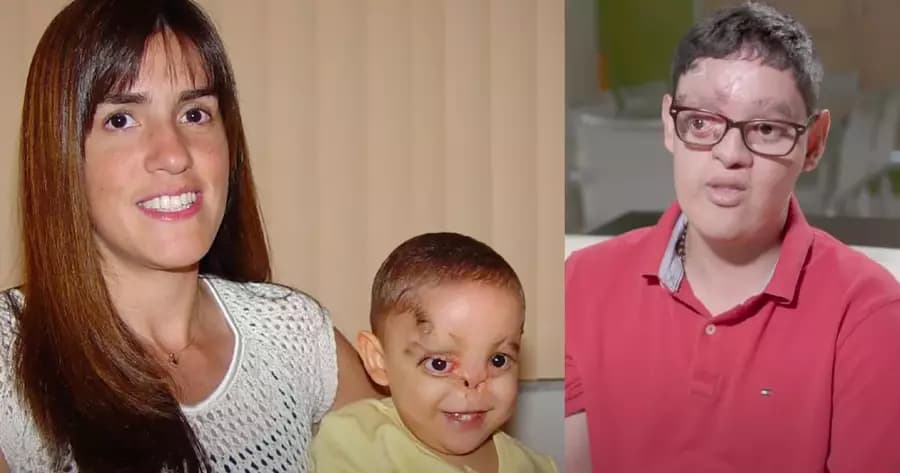 Gray sobreviveu milagrosamente. (Foto: Reprodução/YouTube/American Society of Plastic Surgeons).
