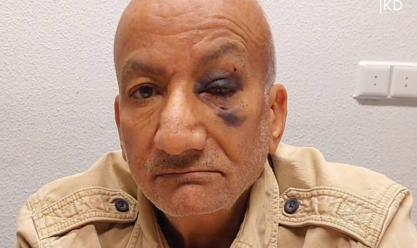 Idoso foi agredido por socos no rosto. (Captura de tela/Omroep West)
