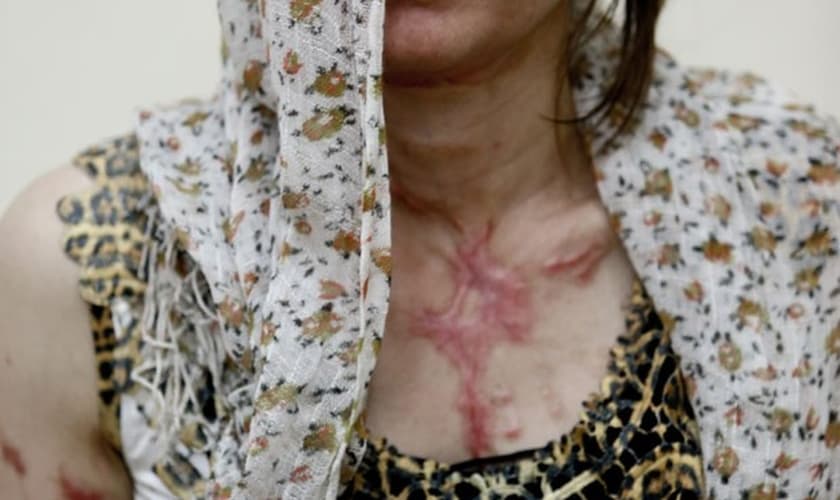 A síria Andi, de 30 anos; ela veio para o Brasil com o marido, após ser atacada com ácido em sua cidade natal. (Foto: Gabriel Chaim/G1)