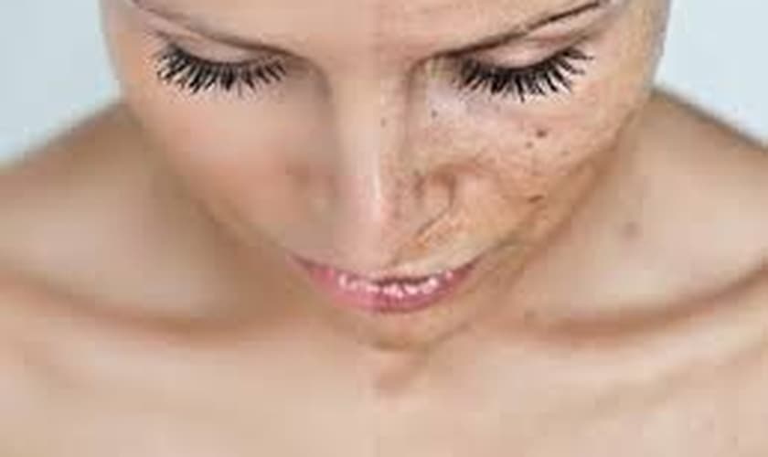 maquiagem para pele manchada