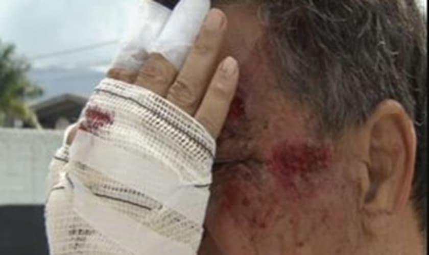 Comerciante teve ferimentos na mão e no rosto