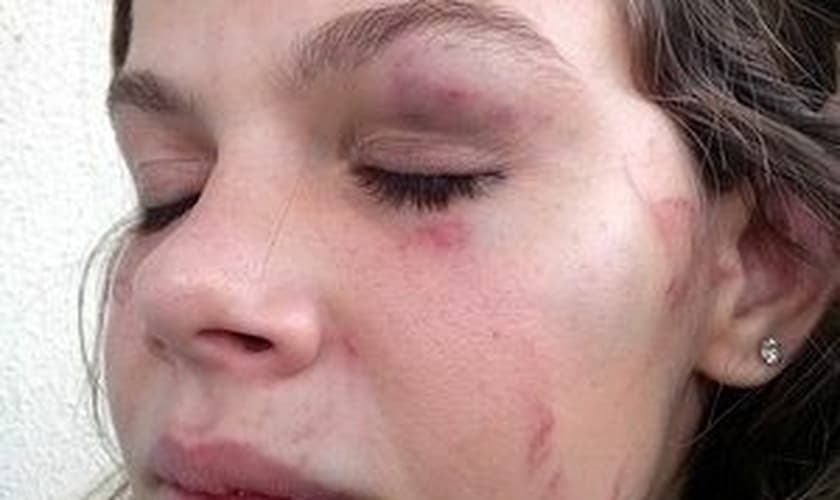 Estudante de 15 anos foi espancada em escola