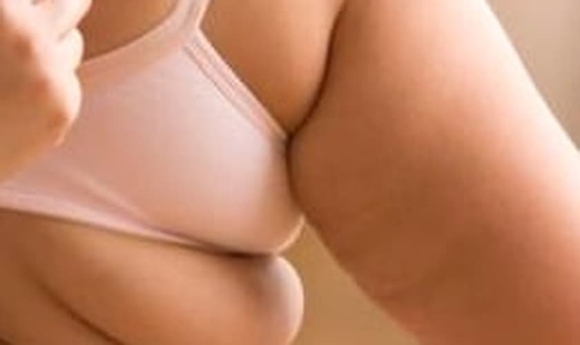obesidade