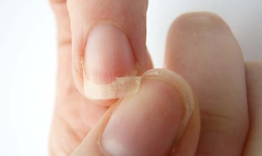 unhas saudáveis