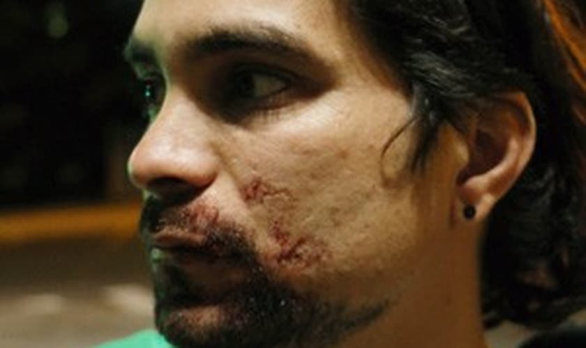Colombiano José Daniel Menezes diz ter sido espancado em Porto Alegre