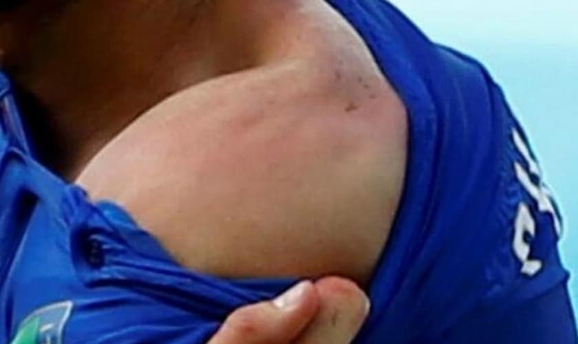 Zagueiro Chiellini mostra ombro supostamente mordido por Suárez