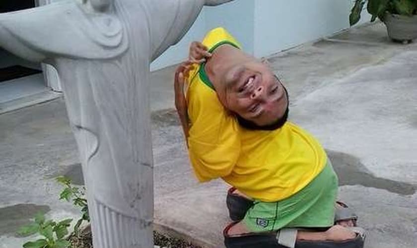 Claudio diz que sempre viveu tentando se adaptar ao mundo e, hoje, se considera uma "pessoa normal"