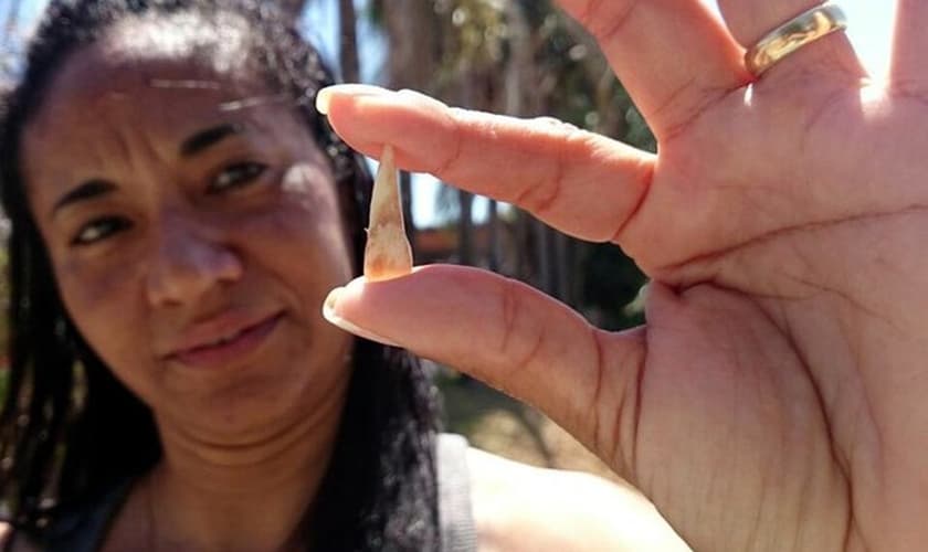 Mãe mostra dente que a filha perdeu após apanhar na escola em Sorocaba