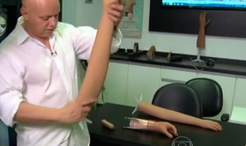 Menino afirmou que tem interesse em desenhar um tigre na prótese