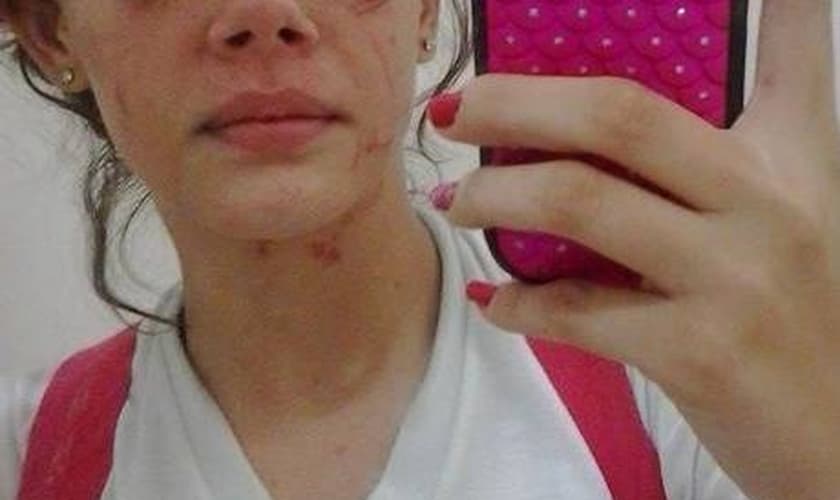 Limeira (SP). Ágatha Roque, também espancada no colégio: sequelas neurológicas