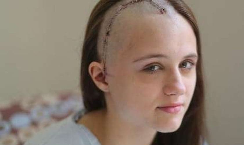 Sophia Putney-Wilcox foi atingida por um taco de beisebol usado pelo irmão para tentar intimidar o agressor