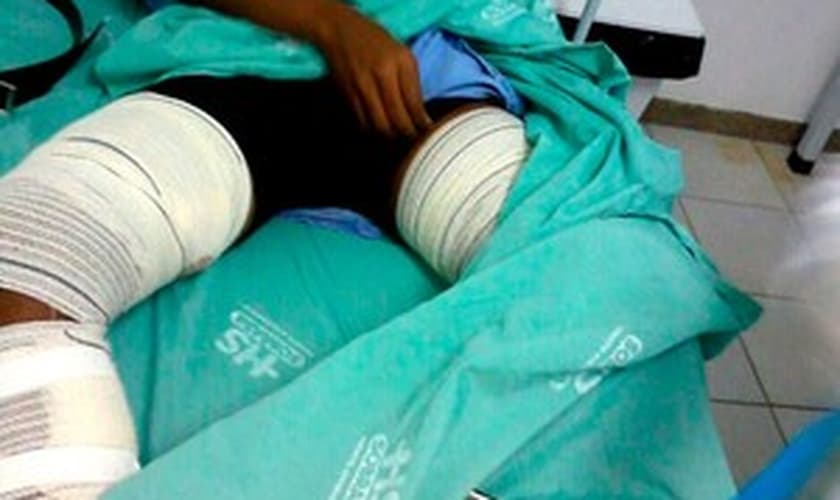 Aspirante a soldado ficou ferido durante explosão