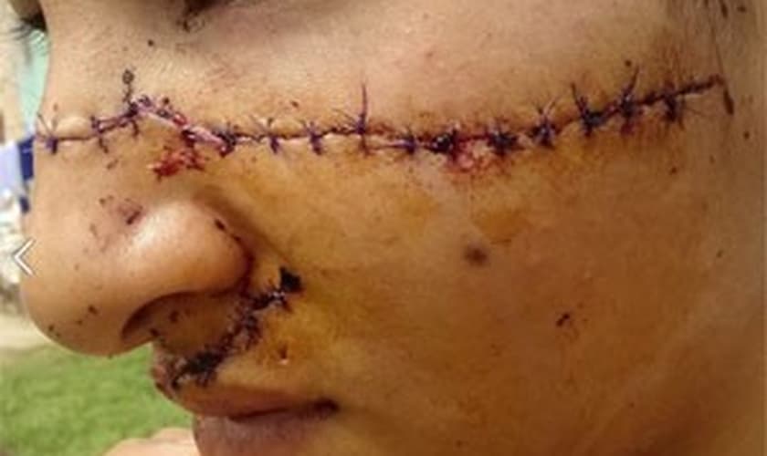 Imagem da jovem agredida foi publicada no Facebook