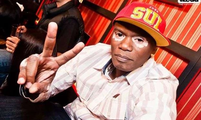 Vitiligo tem tratamento