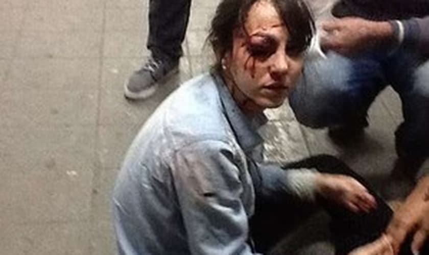 Giuliana Valone, do jornal 'Folha de S.Paulo' foi ferida por bala de borracha no rosto