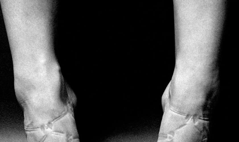 Ensio "Impression" revela marcas nos corpos de mulheres em busca da vaidade