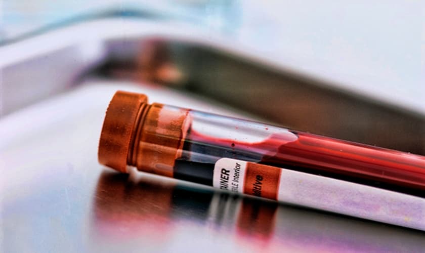 Exame de sangue