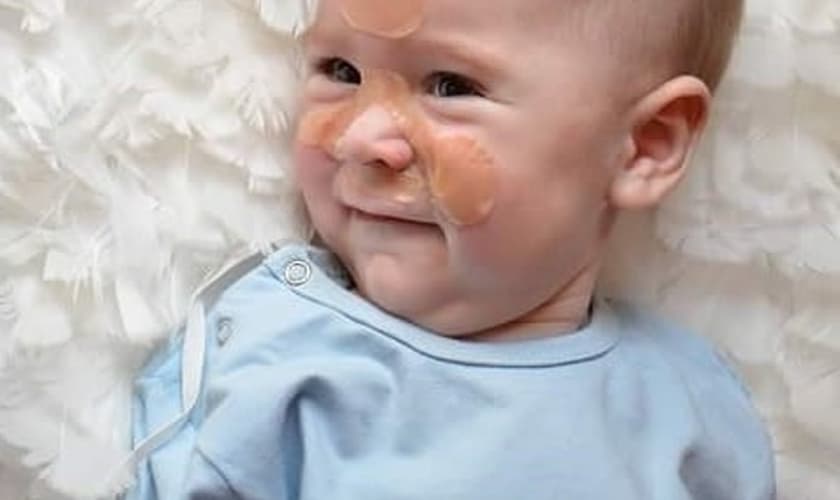 Miguel sofre de Atrofia Muscular Espinhal Tipo 1 (tipo mais grave).