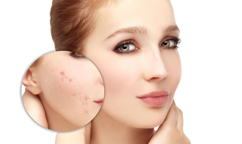 (Foto: Reprodução)