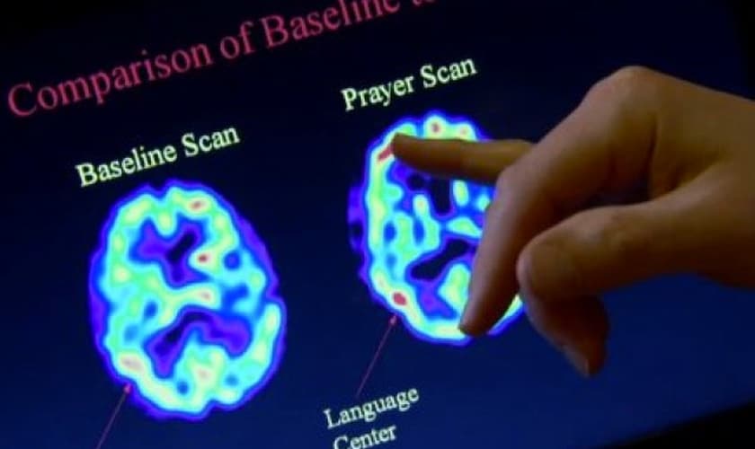 Análise entre o cérebro no estado normal e o cérebro durante oração. (Foto: Reprodução/ Centre Chiro)