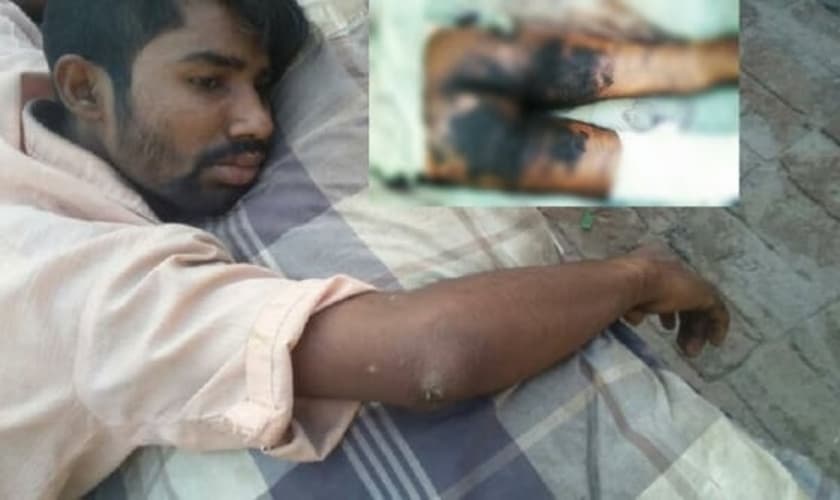 Ansar diz que ainda está traumatizado pelo ataque. “Estou com muito medo de sair de casa". (Foto: Reprodução).