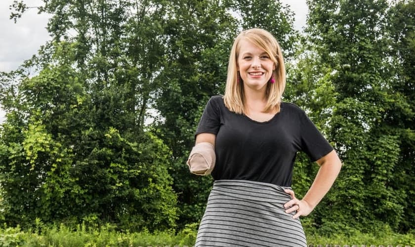 Tiffany Johnson sobreviveu a um ataque de tubarão nas Bahamas, pela intervenção de Deus. (Foto: James Nix/Independent Tribune)