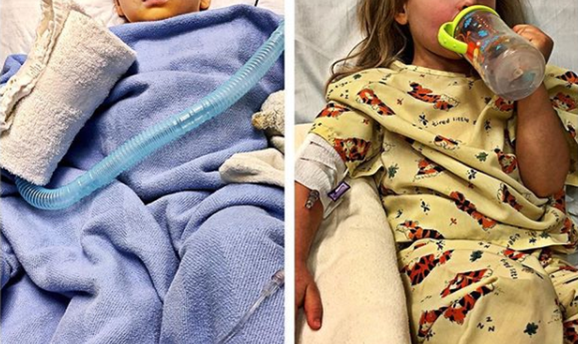 Jaxon, de dois anos e Addie, de quatro anos, contraíram a mesma infecção. (Foto: Reprodução/Instagram)