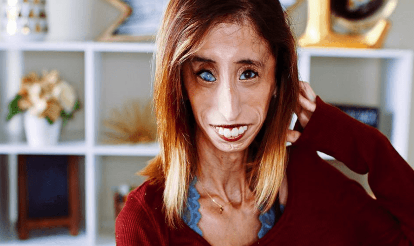 Lizzie Velasquez inspira milhões de pessoas com sua história de superação. (Foto: Reprodução/Instagram)