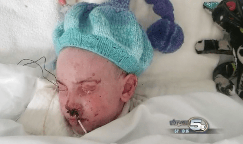 Thelonious foi diagnosticado com a síndrome de Stevens-Johnson, que afetou a pele de todo o seu corpo. (Foto: Reprodução/WKRG)