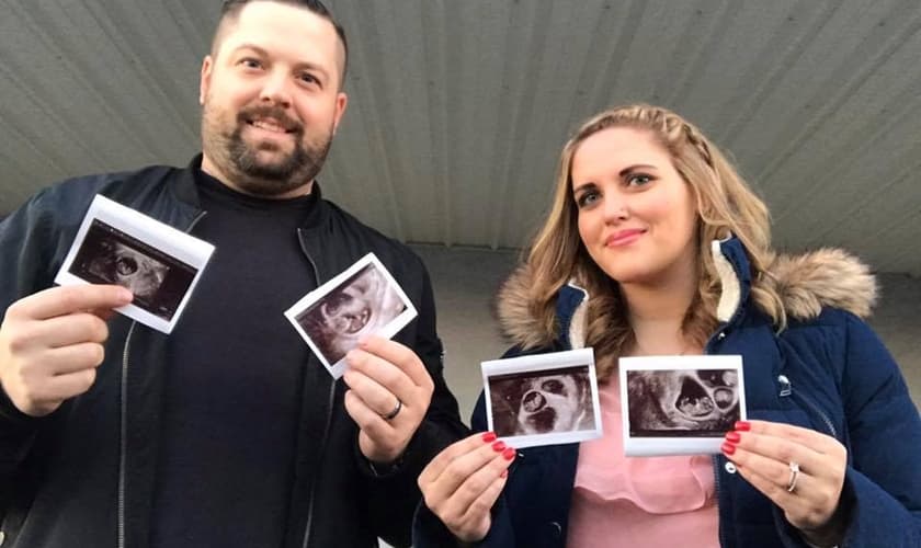 Kenny e Kayla Green seguram as imagens da ultrassonografia, que registrou os quádruplos. (Foto: Reprodução/Facebook)