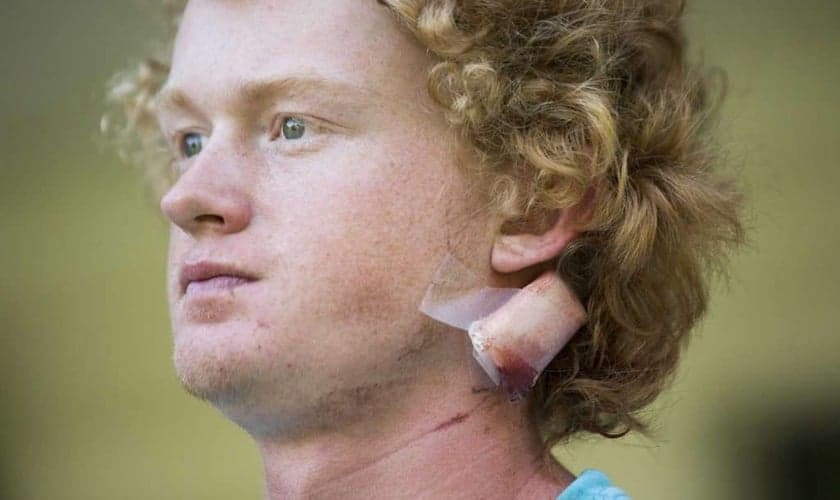 Rome Shubert teve a cabeça atingida. (Foto: Marie D. De Jesus, Houston Chronicle / Houston Chronicle).