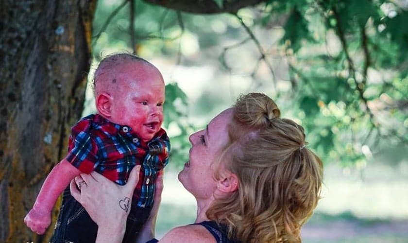 Alicia segurando o filho, Jamison, portador de um raro distúrbio genético chamado ictiose arlequim. (Foto: Kristen Lauren Photography)