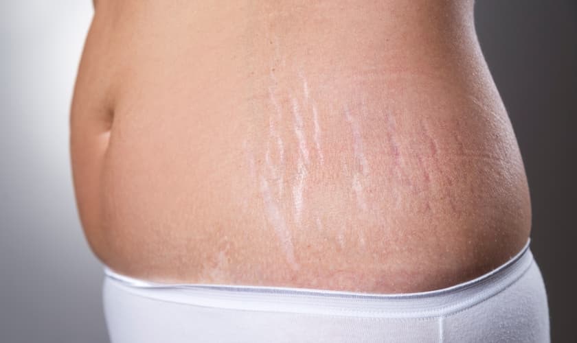 (Foto: Reprodução)