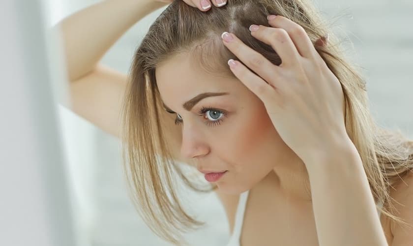 Mais de 50% das mulheres têm alguma queixa relacionada à queda de cabelos. (Foto: Shutterstock)