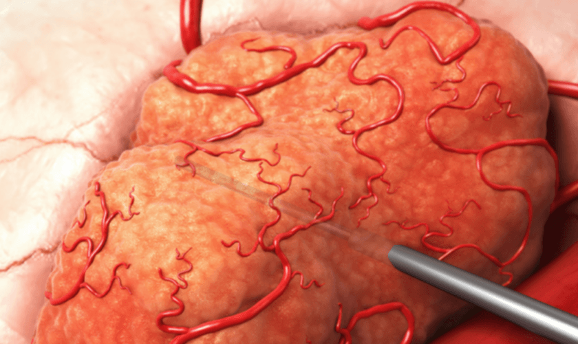 Imagem ilustrativa de órgão em tratamento. (Foto: Divulgação/Alfa Tau)