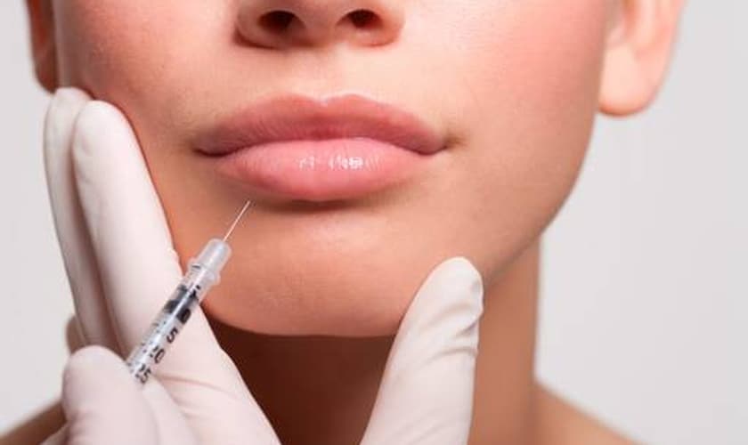 Diversos ativos preenchedores permitem uma boa integração entre os tecidos e um resultado natural. (Foto: Reprodução)