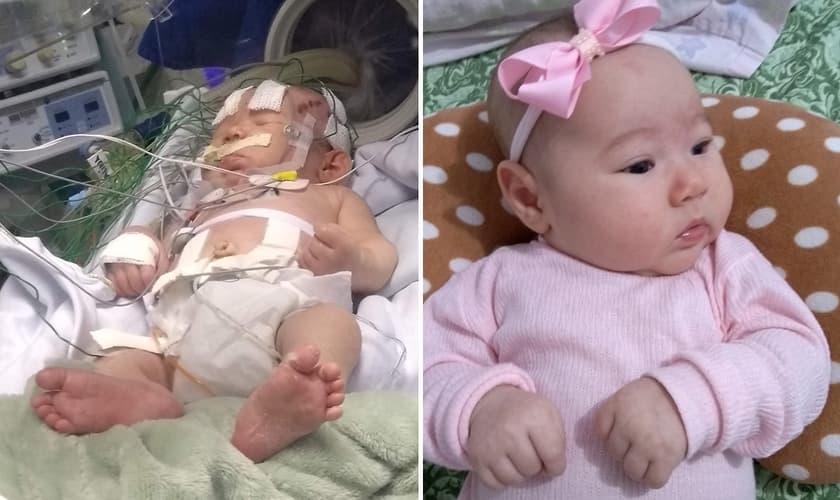 Sarah de Lima hoje, aos três meses; e, à esquerda, quando estava internada na UTI Neonatal com complicações em decorrência da hipoglicemia detectada com um dia de vida. (Foto: Reprodução/Mariane Lima)