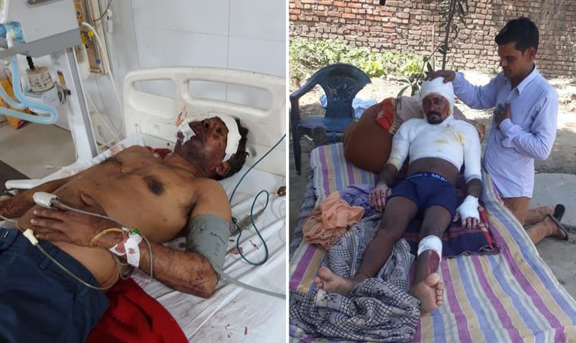 Cristãos espancado e pastor que teve o corpo incendiado recebe oração de um cristão, irmão do pastor Rashphal. (Foto: Divulgação/Rashphal.)