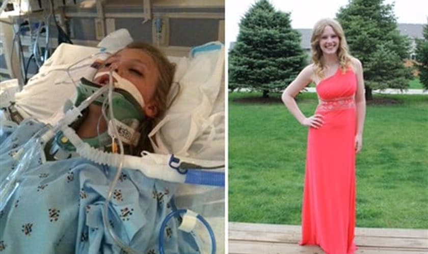 Taylor Hale internada na UTI e hoje, com 17 anos, antes de seu baile de formatura. (Foto: Reprodução/Stacy Henningsen).
