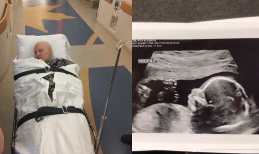 Depois de superar o câncer, Kyla Kruse celebra a gravidez. (Foto: Reprodução/KWCH)