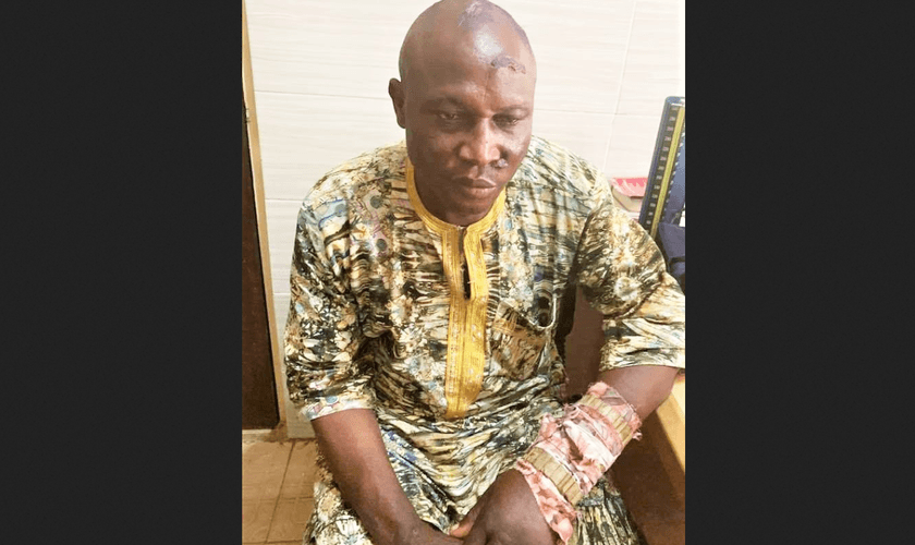 Pastores muçulmanos Fulani feriram o pastor batista Elisha Noma enquanto o mantinham em cativeiro. (Foto: Reprodução/Morning Star News)