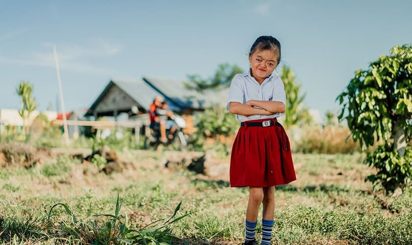 Karunia nasceu com Síndrome de Apert, mas não deixou de se sentir confiante. (Foto: Compassion International)