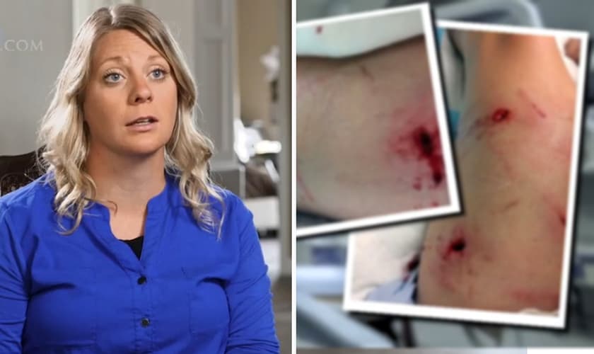 Casadi Schroeder foi atacada por um urso durante um acampamento bíblico no Canadá. (Foto: CBN News)